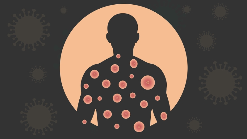 Silhouette of person with virus graphic