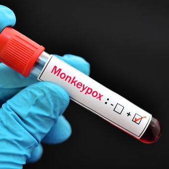 Gloved hand holding positive monkeypox vile
