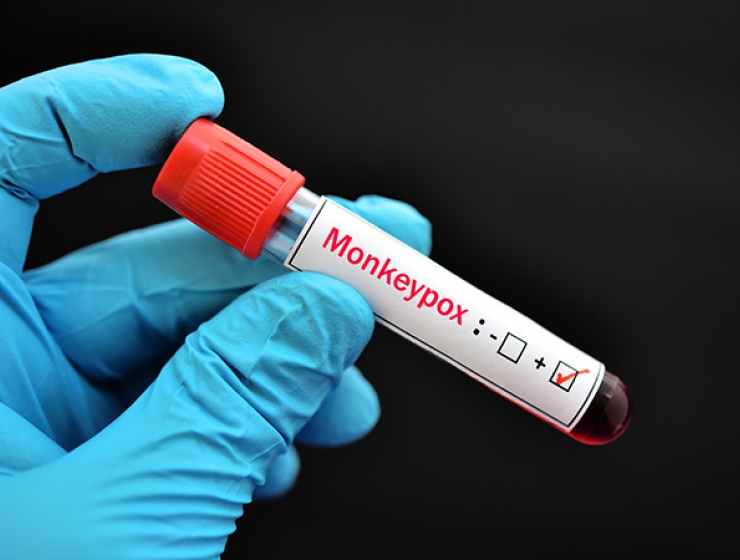 Gloved hand holds positive monkeypox vile