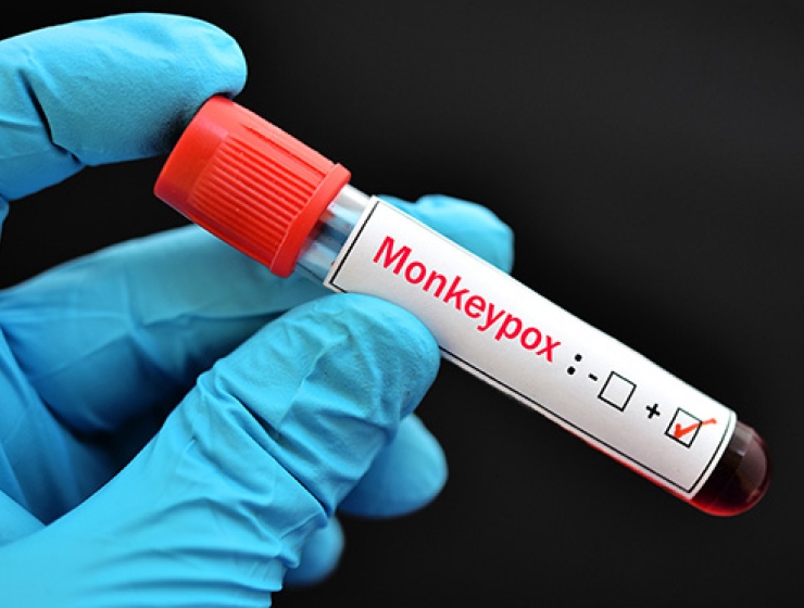Gloved hand holding positive monkeypox vile